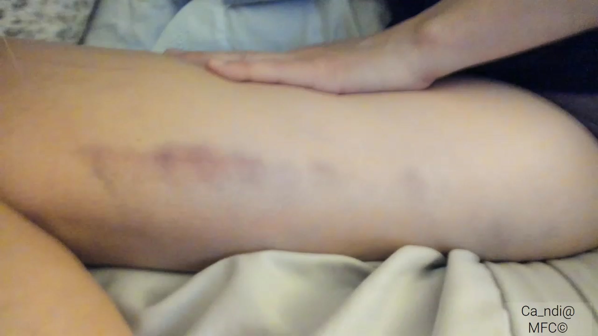 Gallery image thumbnail from Ca_ndi's myfreecams stream on, 03/04/2023, 10:08 image 16 of 20