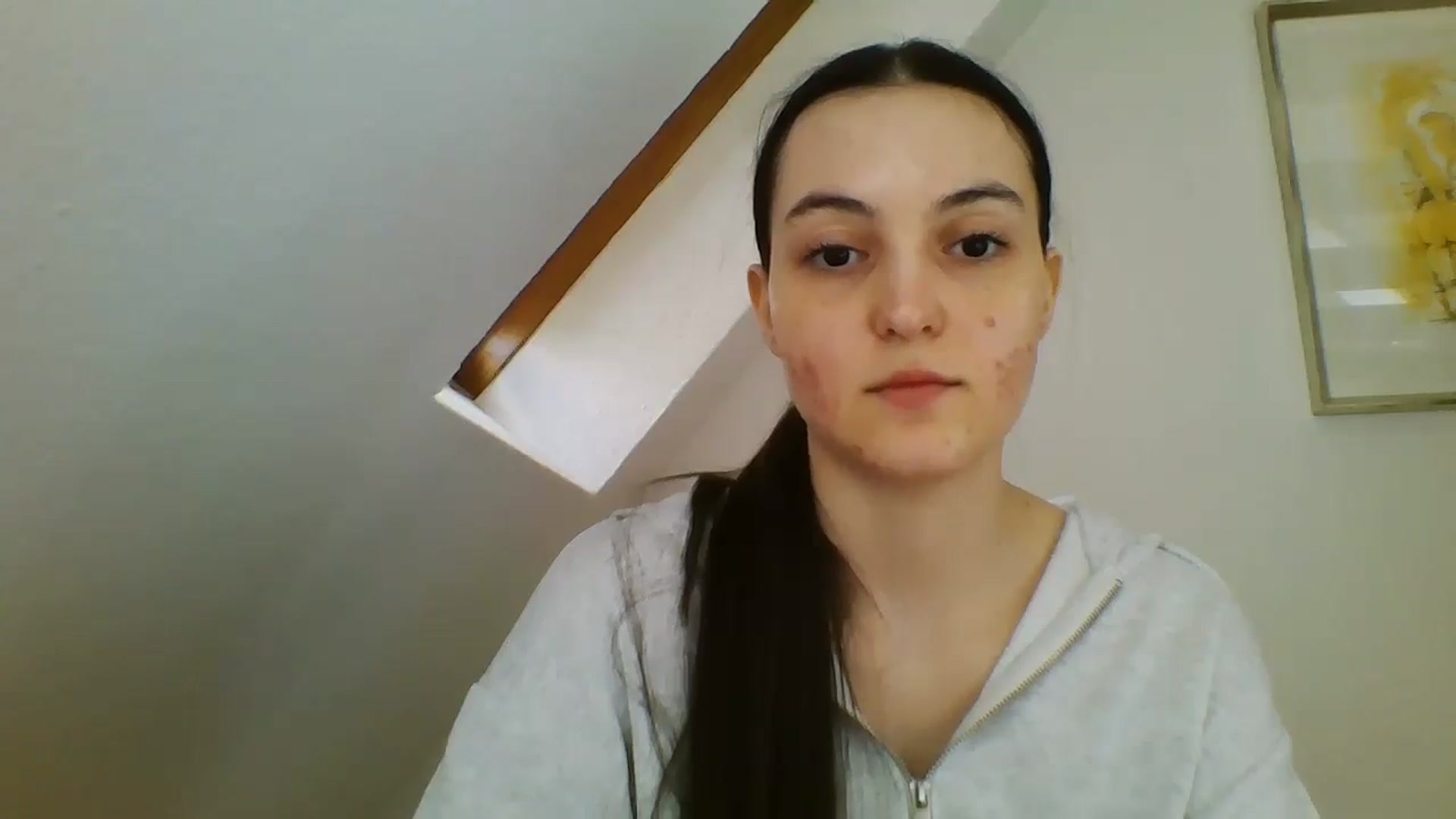 Gallery image thumbnail from IrisAmore's myfreecams stream on, 03/30/2025, 11:30 image 16 of 20