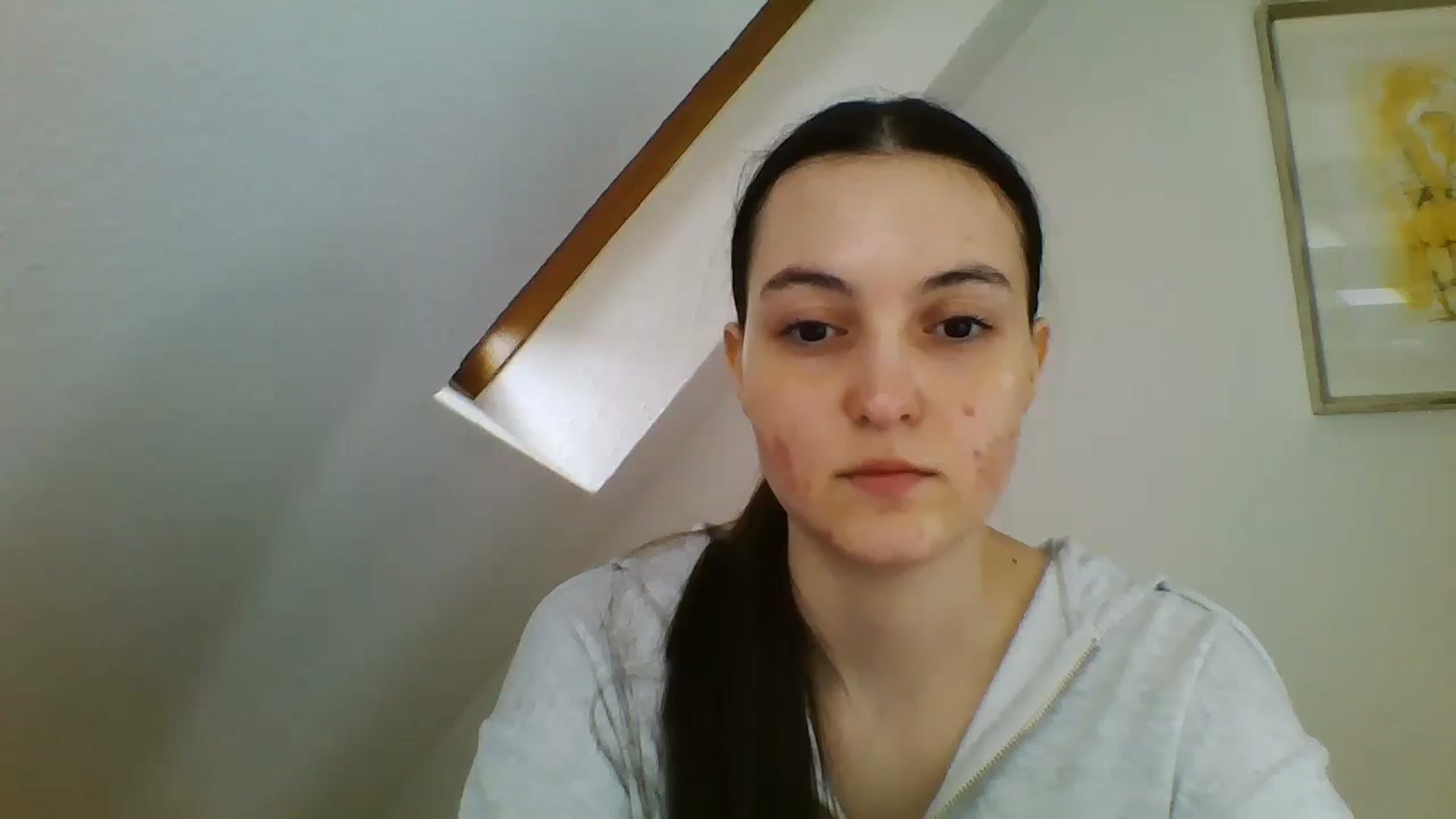 Gallery image thumbnail from IrisAmore's myfreecams stream on, 03/30/2025, 11:30 image 15 of 20
