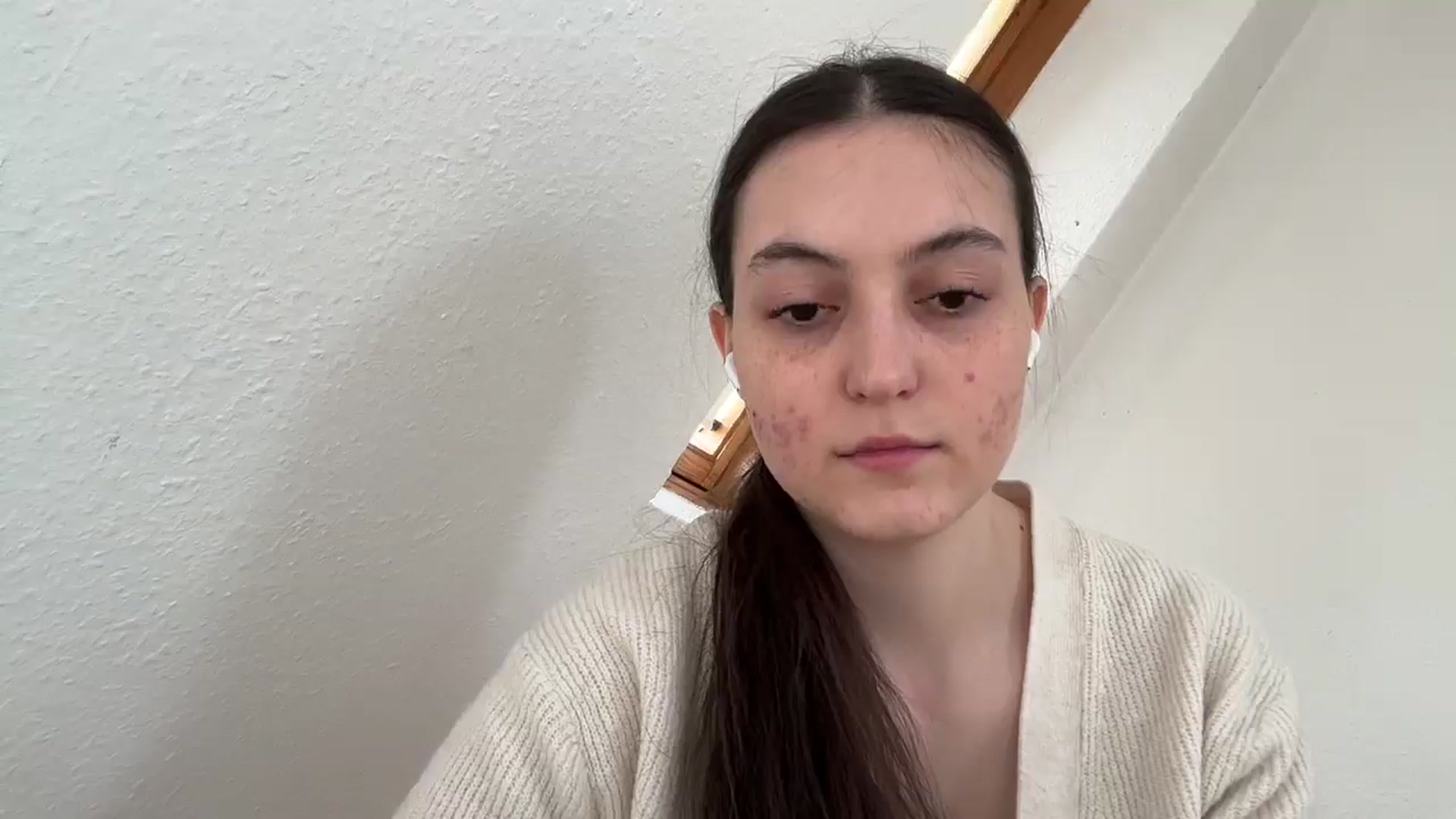 Gallery image thumbnail from IrisAmore's myfreecams stream on, 04/18/2025, 11:31 image 5 of 20