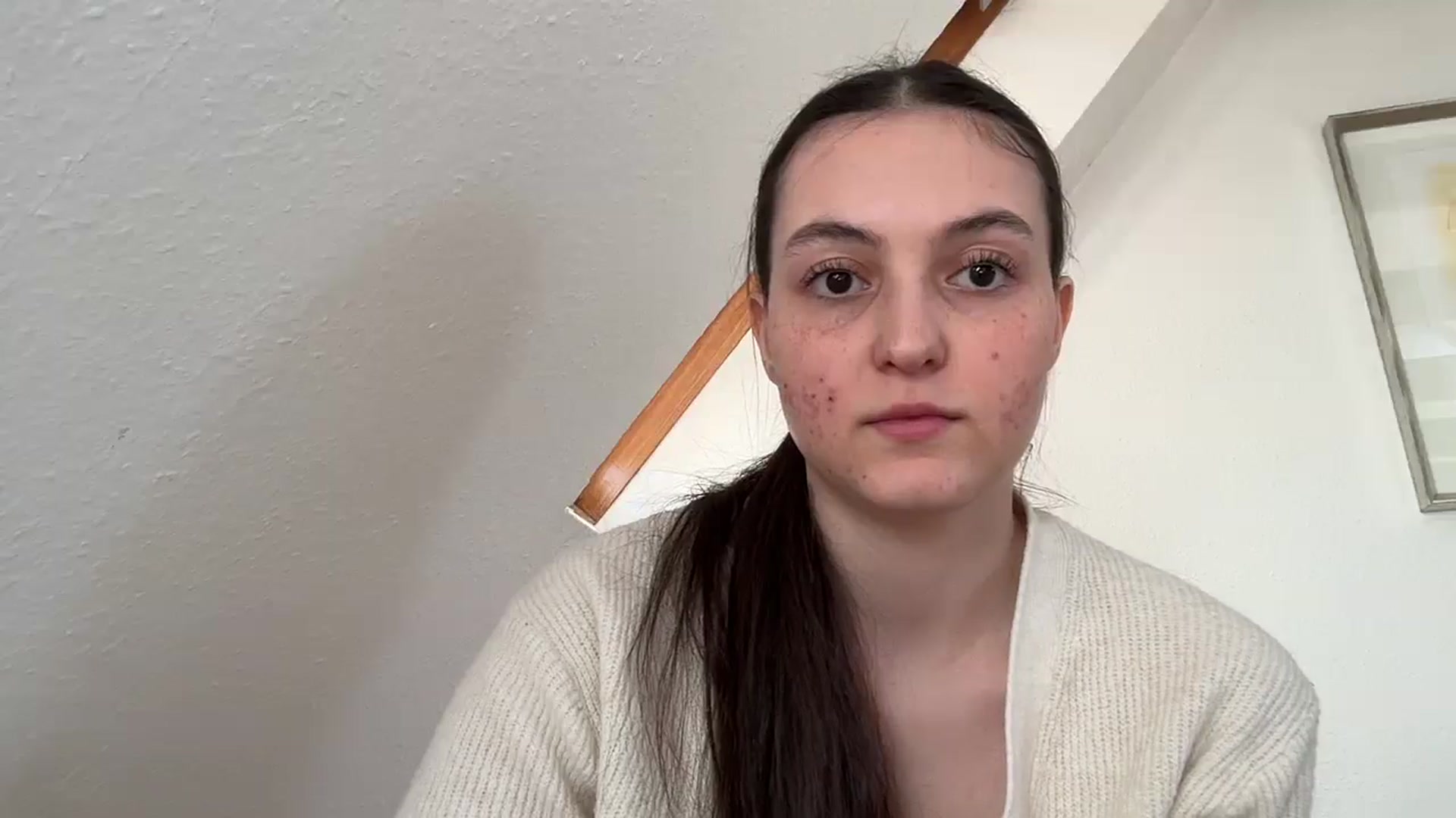 Gallery image thumbnail from IrisAmore's myfreecams stream on, 04/19/2025, 13:16 image 8 of 20