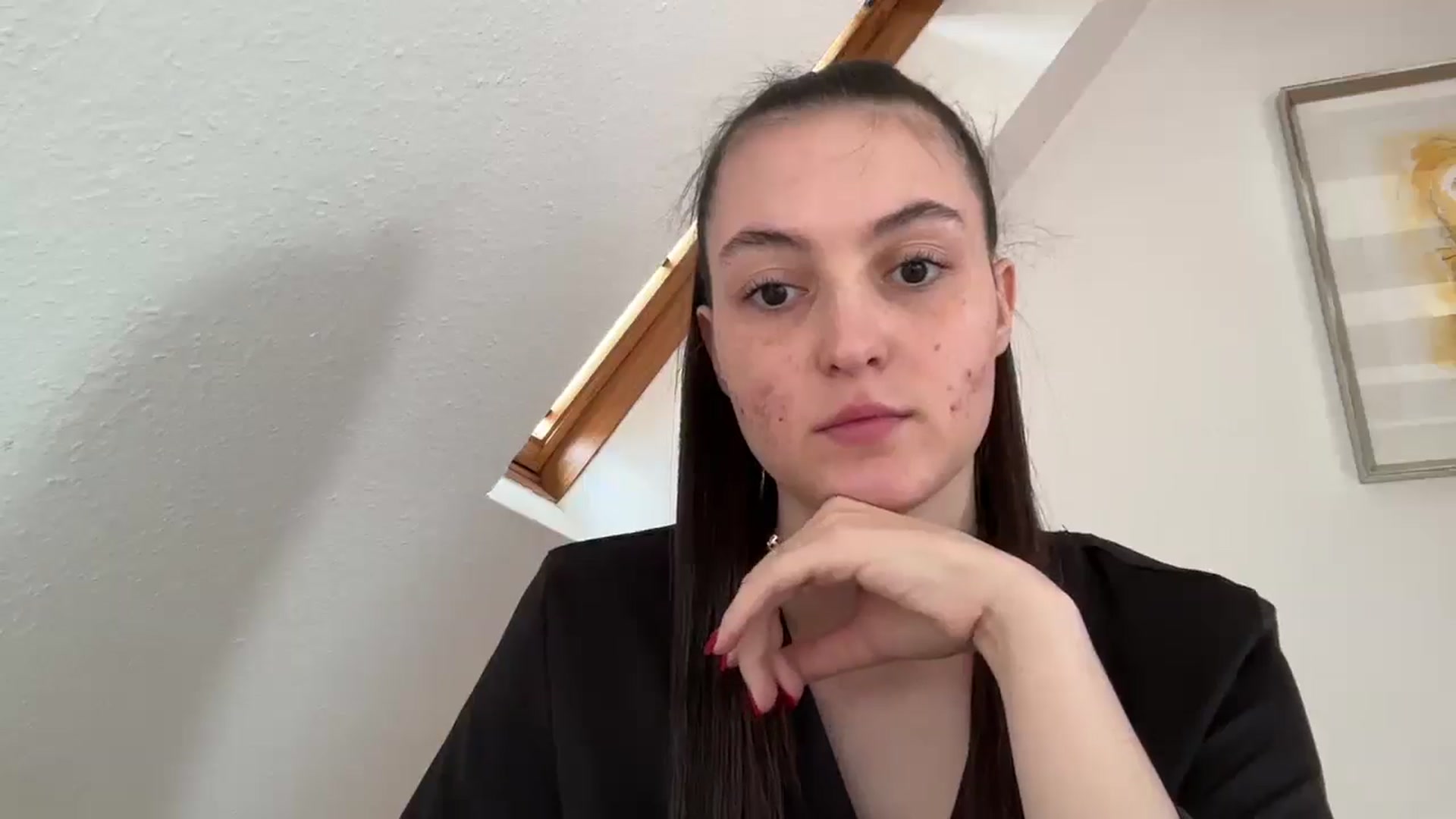 Gallery image thumbnail from IrisAmore's myfreecams stream on, 05/04/2025, 11:20 image 7 of 20