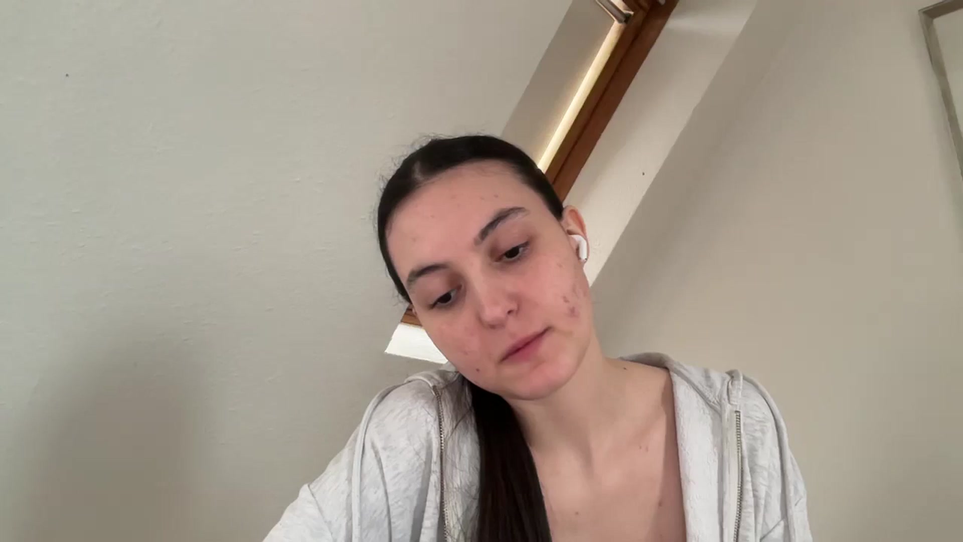 Gallery image thumbnail from IrisAmore's myfreecams stream on, 04/13/2026, 17:32 image 16 of 20