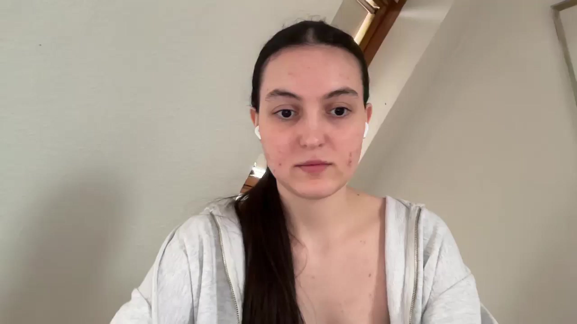 Gallery image thumbnail from IrisAmore's myfreecams stream on, 04/13/2026, 17:32 image 13 of 20