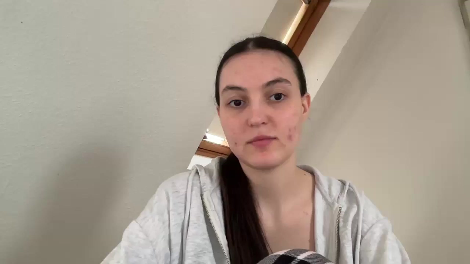 Gallery image thumbnail from IrisAmore's myfreecams stream on, 04/13/2026, 17:32 image 2 of 20