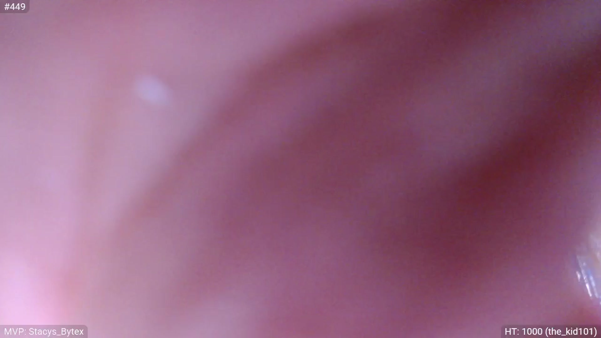 Gallery image thumbnail from StacyDoll's myfreecams stream on, 01/10/2026, 23:04 image 18 of 20