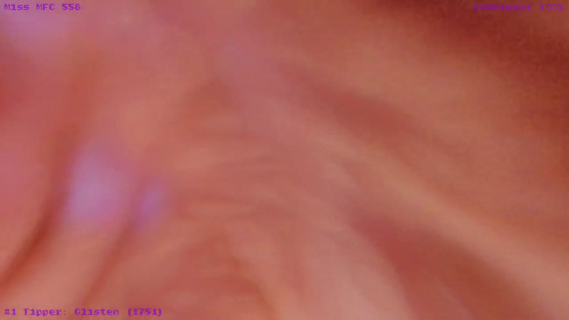 Gallery image thumbnail from xDaisyx's myfreecams stream on, 03/16/2026, 16:04 image 16 of 20