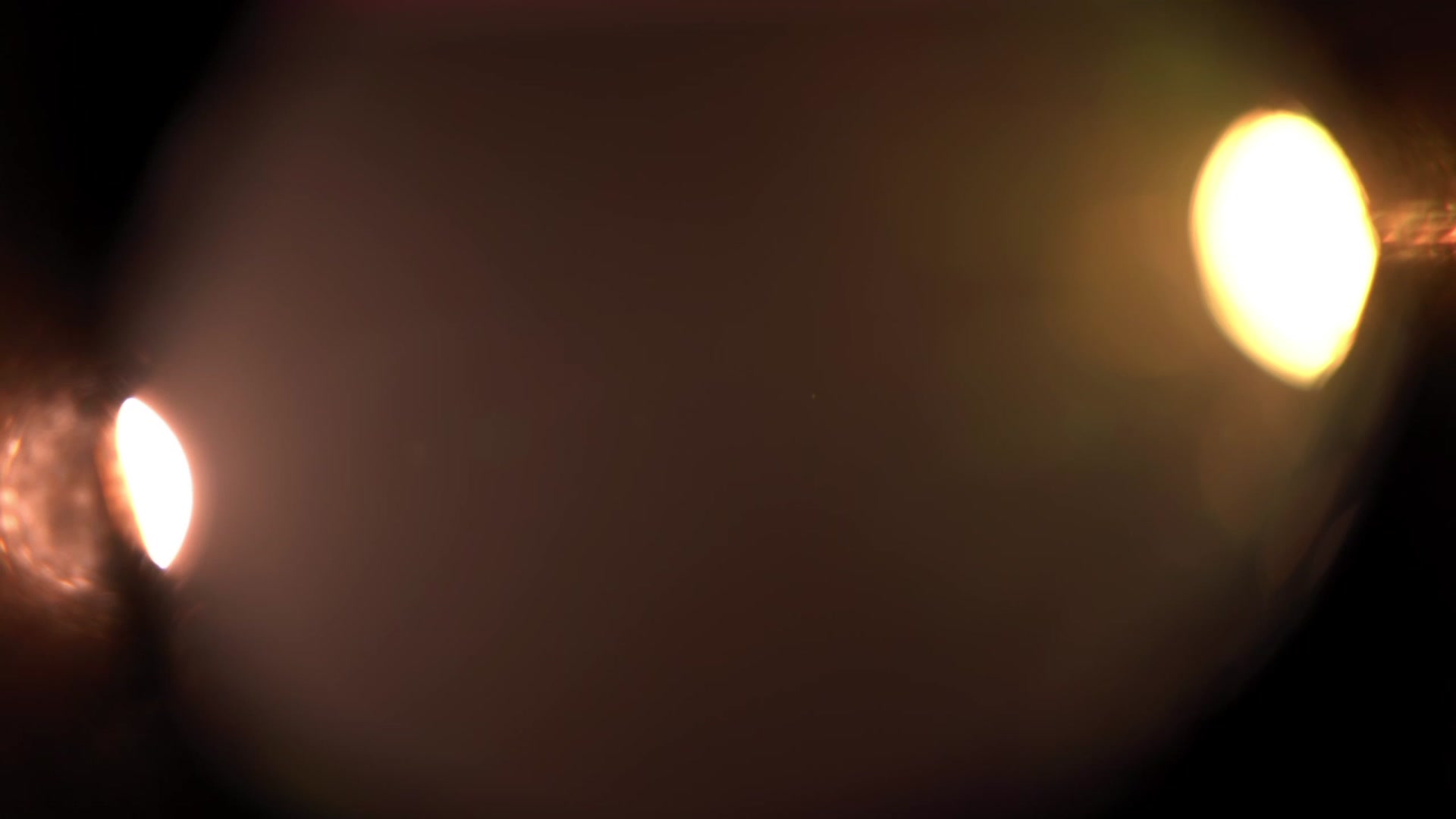 Artlene video thumbnail