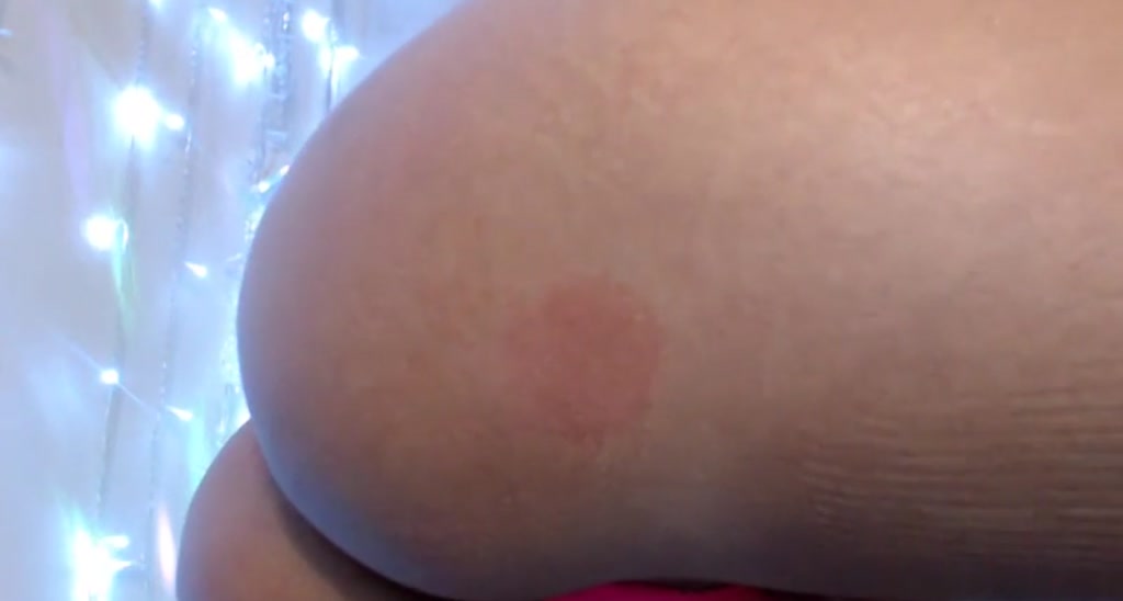 MalanaTwitch video thumbnail