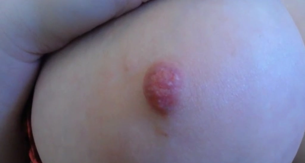ZillyKitty video thumbnail
